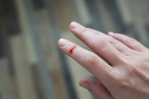 img of Cuts